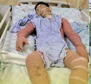 پسر فداکار 2 زن را از مرگ نجات داد