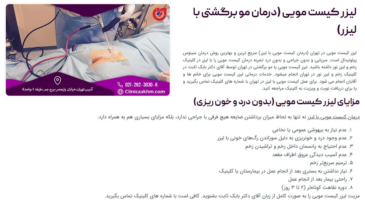 لیزر کیست مویی و مزایای آن