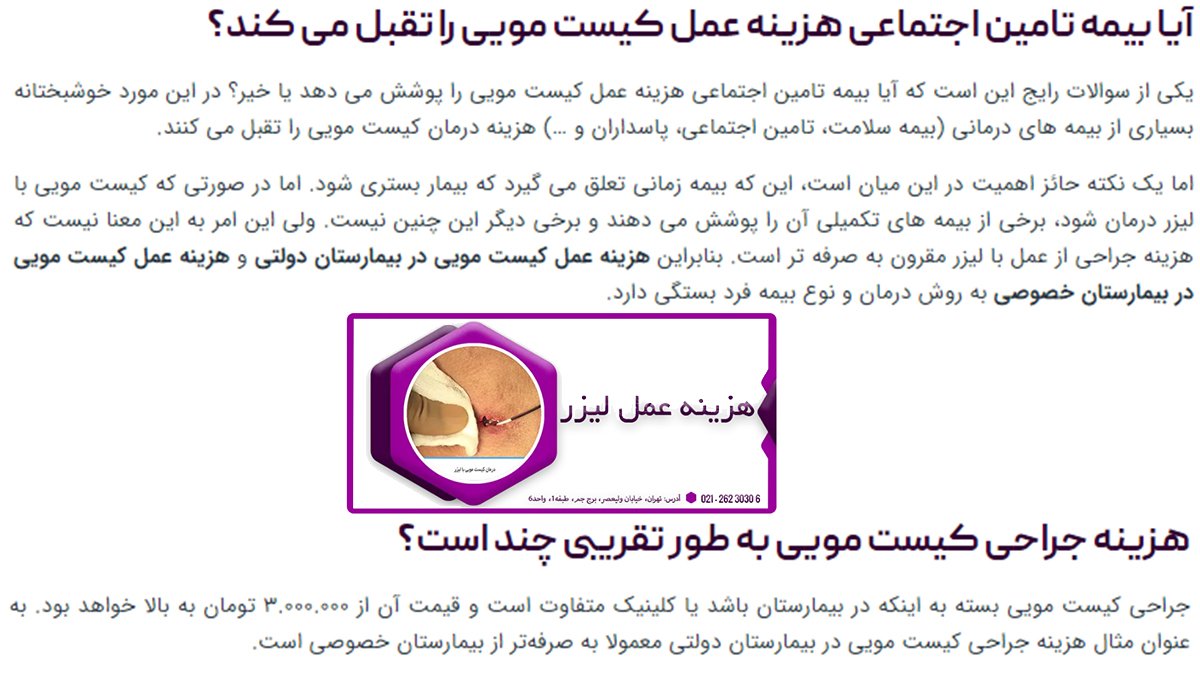 بیمه و درمان کیست مویی با لیزر